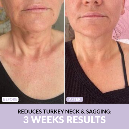 Anti-Wrinkle Skincare Set