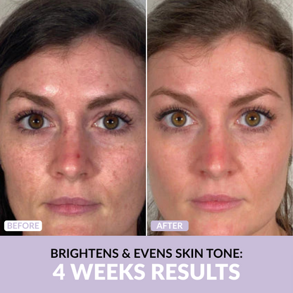 Anti-Wrinkle Skincare Set
