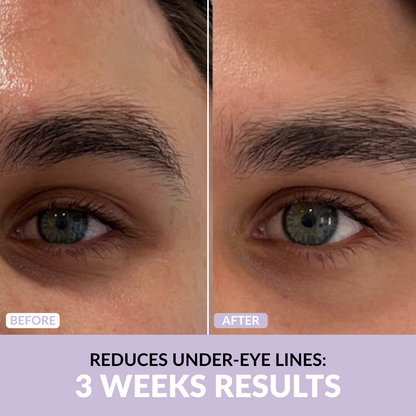 Anti-Wrinkle Skincare Set
